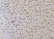IHC staining of FFPE mouse brain tissue with THAP11 antibody. HIER: boil tissue sections in pH8 EDTA for 20 min and allow to cool before testing.