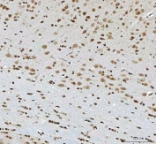 IHC staining of FFPE rat brain tissue with THAP11 antibody. HIER: boil tissue sections in pH8 EDTA for 20 min and allow to cool before testing.