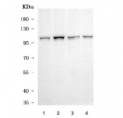 Western blot testing of human 1) HeLa, 2) MCF7, 3) 293T and 4) Jurkat cell lysate with CVAK104 antibody. Predicted molecular weight ~104 kDa.