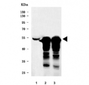 Western blot testing of 1) human HeLa, 2) rat testis and 3) mouse testis tissue lysate with YBX2 antibody. Predicted molecular weight ~39 kDa but commonly observed at ~52 kDa.