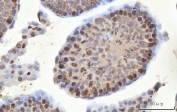 IHC staining of FFPE mouse testis tissue with YBX2 antibody. HIER: boil tissue sections in pH8 EDTA for 20 min and allow to cool before testing.