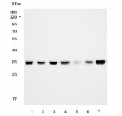 Western blot testing of 1) human SH-SY5Y, 2) human HeLa, 3) human T98G, 4) rat pancreas, 5) rat brain, 6) mouse pancreas and 7) mouse brain tissue lysate with SCAMP1 antibody. Predicted molecular weight ~35 kDa.