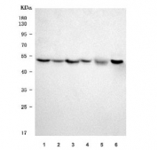 Western blot testing of 1) human Jurkat, 2) human HepG2, 3) human MOLT4, 4) human SiHa, 5) rat brain and 6) mouse brain tissue lysate with Selenophosphate synthetase 1 antibody. Predicted molecular weight ~43 kDa.