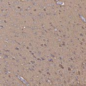 IHC staining of FFPE rat brain tissue with Selenophosphate synthetase 1 antibody. HIER: boil tissue sections in pH8 EDTA for 20 min and allow to cool before testing.
