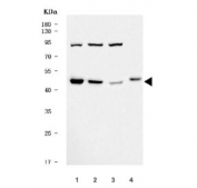 Western blot testing of human 1) SH-SY5Y, 2) Jurkat, 3) K562 and 4) U-2 OS cell lysate with TSPYL5 antibody. Predicted molecular weight ~45 kDa.