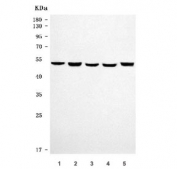 Western blot testing of 1) human SH-SY5Y, 2) human MOLT4, 3) rat thymus, 4) rat brain and 5) mouse brain tissue lysate with Septin 6 antibody. Predicted molecular weight ~50 kDa.