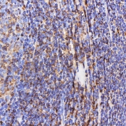 IHC staining of FFPE human tonsil tissue with Septin 6 antibody. HIER: boil tissue sections in pH8 EDTA for 20 min and allow to cool before testing.