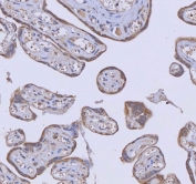 IHC staining of FFPE human placental tissue with WDR44 antibody. HIER: boil tissue sections in pH8 EDTA for 20 min and allow to cool before testing.