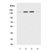 Western blot testing of human 1) SiHa, 2) HeLa, 3) HEL and 4) A431 cell lysate with WDR44 antibody. Predicted molecular weight ~101 kDa.