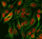 Immunofluorescent staining of FFPE human HeLa cells with SCML1 antibody (red) and Alpha Tubulin mAb (green). HIER: steam section in pH6 citrate buffer for 20 min.