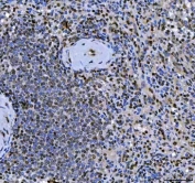 IHC staining of FFPE human spleen tissue with SCML1 antibody. HIER: boil tissue sections in pH8 EDTA for 20 min and allow to cool before testing.