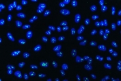 Immunofluorescent staining of FFPE human A549 cells with WD repeat-containing protein 3 antibody (green) and DAPI nuclear stain (blue). HIER: steam section in pH6 citrate buffer for 20 min.