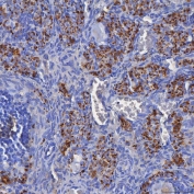 IHC staining of FFPE mouse ovary tissue with SDF2L1 antibody. HIER: boil tissue sections in pH8 EDTA for 20 min and allow to cool before testing.