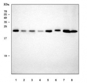 Western blot testing of 1) human K562, 2) human 293T, 3) human HepG2, 4) human MCF7, 5) rat pancreas, 6) rat testis, 7) mouse pancreas and 8) mouse testis tissue lysate with SDF2L1 antibody. Predicted molecular weight ~24 kDa.