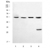 Western blot testing of human 1) HepG2, 2) K562, 3) 293T and 4) U-87 MG cell lysate with TRIM50 antibody. Predicted molecular weight ~55 kDa.
