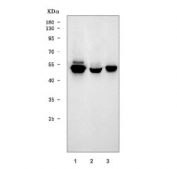 Western blot testing of 1) human HeLa, 2) monkey COS-7 and 3) human placental tissue lysate with TDG antibody. Predicted molecular weight ~46 kDa.