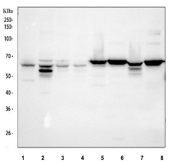 Western blot testing of 1) human 293T, 2) human MCF7, 3) human K562, 4) human SH-SY5Y, 5) rat thymus, 6) rat brain, 7) mouse thymus and 8) mouse brain tissue lysate with TDG antibody. Predicted molecular weight ~46 kDa but may be observed at higher molecular weights due to ubiquitination and sumoylation.