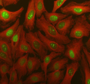 Immunofluorescent staining of FFPE human HeLa cells with TDG antibody (green) and Alpha Tubulin mAb (red). HIER: steam section in pH6 citrate buffer for 20 min.