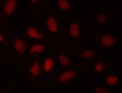 Immunofluorescent staining of FFPE human U-2 OS cells with SDE2 antibody (red). HIER: steam section in pH6 citrate buffer for 20 min.