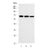 Western blot testing of human 1) HeLa, 2) 293T and 3) Jurkat cell lysate with THUMP domain-containing protein 3 antibody. Predicted molecular weight ~57 kDa.