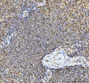 IHC staining of FFPE human spleen tissue with TIGD1 antibody. HIER: boil tissue sections in pH8 EDTA for 20 min and allow to cool before testing.