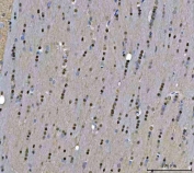 IHC staining of FFPE mouse brain tissue with TIGD1 antibody. HIER: boil tissue sections in pH8 EDTA for 20 min and allow to cool before testing.