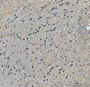 IHC staining of FFPE rat brain tissue with TIGD1 antibody. HIER: boil tissue sections in pH8 EDTA for 20 min and allow to cool before testing.