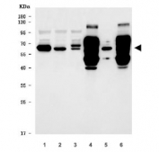 Western blot testing of 1) human HeLa, 2) human Jurkat, 3) human SH-SY5Y, 4) rat brain, 5) rat stomach and 6) mouse brain tissue lysate with TIGD1 antibody. Predicted molecular weight ~67 kDa.