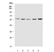 Western blot testing of 1) human T-47D, 2) human U-87 MG, 3) human A549, 4) human MCF7 and 5) rat testis tissue lysate with TIGD6 antibody. Predicted molecular weight ~59 kDa.