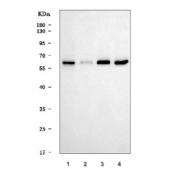 Western blot testing of human 1) HepG2, 2) T-47D, 3) SH-SY5Y and 4) MCF7 cell lysate with TIGD3 antibody. Predicted molecular weight ~52 kDa.