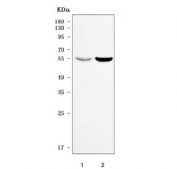 Western blot testing of human 1) HeLa and 2) A549 cell lysate with SDCCAG3 antibody. Predicted molecular weight: 40-48 kDa (multiple isoforms), but may be observed at higher molecular weights due to phosphorylation.
