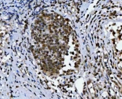 IHC staining of FFPE human tonsil tissue with TRIR antibody. HIER: boil tissue sections in pH8 EDTA for 20 min and allow to cool before testing.