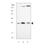 Western blot testing of human 1) MCF7, 2) 293T and 3) HepG2 cell lysate with TRIR antibody. Predicted molecular weight ~18 kDa.