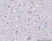 IHC staining of FFPE mouse brain tissue with TWIST1/2 antibody. HIER: boil tissue sections in pH8 EDTA for 20 min and allow to cool before testing.