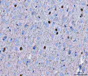 IHC staining of FFPE rat brain tissue with TWIST1/2 antibody. HIER: boil tissue sections in pH8 EDTA for 20 min and allow to cool before testing.