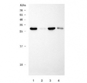 Western blot testing of 1) rat brain, 2) rat ovary, 3) mouse brain and 4) mouse ovary tissue lysate with TWIST1/2 antibody. Predicted molecular weight ~21 kDa, commonly observed at 25-30 kDa.