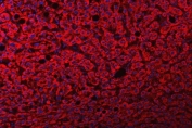 Immunofluorescent staining of FFPE human liver cancer tissue with FRY antibody (red) and DAPI nuclear stain (blue). HIER: steam section in pH8 EDTA buffer for 20 min.