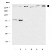 Western blot testing of 1) human RT4, 2) human Caco-2, 3) rat brain, 4) rat lung, 5) mouse brain and 6) mouse lung tissue lysate with FRY antibody. Predicted molecular weight ~339 kDa.