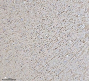 IHC staining of FFPE rat brain tissue with CNP antibody. HIER: boil tissue sections in pH8 EDTA for 20 min and allow to cool before testing.