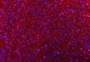 Immunofluorescent staining of FFPE mouse brain tissue with CNP antibody (red) and DAPI nuclear stain (blue). HIER: boil tissue sections in pH8 EDTA for 20 min and allow to cool before testing.
