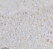 IHC staining of FFPE mouse brain tissue with CNP antibody. HIER: boil tissue sections in pH8 EDTA for 20 min and allow to cool before testing.