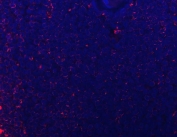 Immunofluorescent staining of FFPE human spleen tissue with CD74 antibody (red) and DAPI nuclear stain (blue). HIER: steam section in pH8 EDTA buffer for 20 min.