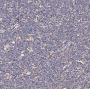 IHC staining of FFPE human tonsil tissue with CD74 antibody. HIER: boil tissue sections in pH8 EDTA for 20 min and allow to cool before testing.
