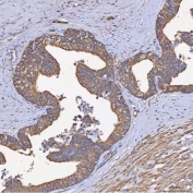 IHC staining of FFPE human colon tissue with HSD11K antibody. HIER: boil tissue sections in pH8 EDTA for 20 min and allow to cool before testing.