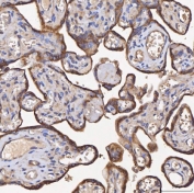 IHC staining of FFPE human placental tissue with HSD11K antibody. HIER: boil tissue sections in pH8 EDTA for 20 min and allow to cool before testing.
