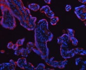 Immunofluorescent staining of FFPE human placental tissue with HSD11K antibody (red) and DAPI nuclear stain (blue). HIER: boil tissue sections in pH8 EDTA for 20 min and allow to cool before testing.