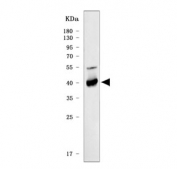 Western blot testing of human placental tissue with HSD11K antibody. Expected molecular weight ~44 kDa.