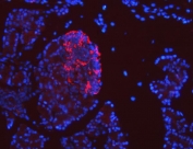 Immunofluorescent staining of FFPE rat pancreas tissue with SEL1L antibody (red) and DAPI nuclear stain (blue). HIER: boil tissue sections in pH8 EDTA for 20 min and allow to cool before testing.