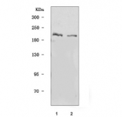 Western blot testing of human 1) 293T and 2) MCF7 cell lysate with DOCK1 antibody. Predicted molecular weight: 215 kDa, routinely observed at 180~215 kDa.