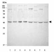 Western blot testing of ) human HeLa, 2) human HepG2, 3) human K562, 4) human MCF7, 5) rat brain, 6) rat liver, 7) mouse brain and 8) mouse liver tissue lysate with NOB1 antibody. Predicted molecular weight ~47 kDa.